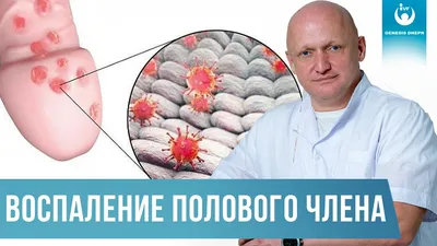 Мужчина 56 лет, многие годы... - Hirudo Med Medical Center | Facebook