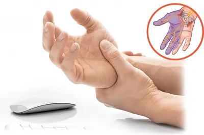 Врачи «СМ-Косметология» рассказали о лечении вросшего ногтя на ноге | Наши  публикации в СМИ