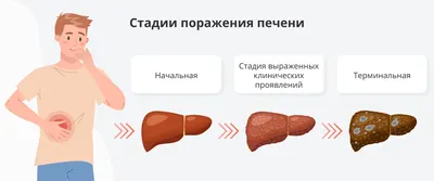 Эксперты назвали признаки больной печени: читать на Golos.ua
