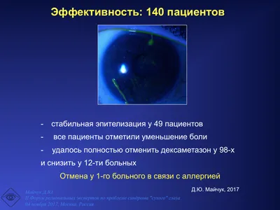 При каком опасном состоянии у человека могут быть \"больные глаза\"