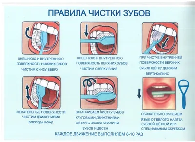 Катаральный стоматит | Виды, лечение | Клиника семейной стоматологии  Дока-Дент