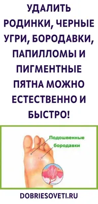 АЛФИТ, Средство для удаления бородавок, папиллом и родинок, ПапилломаФит  5мл — купить в интернет-аптеке OZON. Инструкции, показания, состав, способ  применения