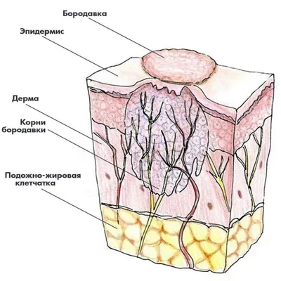 Мозоль корневая (стержневая) | Центр подологии и остеопатии Татьяны Красюк