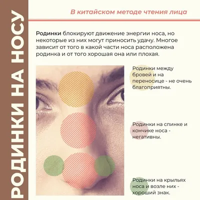 ARclinic - 📸На фото работа врача #арклиник Дроздовой Анны Андреевны. Было  проведено лазерное удаление невуса на носу 🔺Вторая фотография сделана  спустя месяц. Невус был отправлен на гистологическое исследование, поэтому  атрофический рубец ❗По
