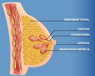 Реальные признаки рака молочной железы