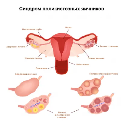 Ветврачи рассказали о профилактике папилломатоза у коров | Ветеринария и  жизнь