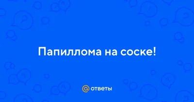 СОСКА ДОБРИЄ, ВИДАЛЯЄ бородавки та курку - docom.com.ua