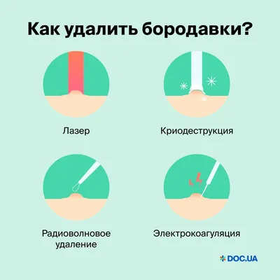 Бородавки у детей: на руках, пальце, ноге | Лечение / удаление бородавок в  Москве ✓ Клиника подологии Полёт