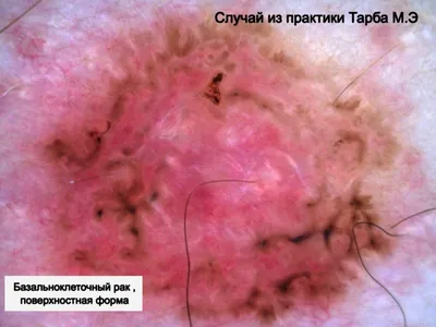 Ваш завтрак под микроскопом