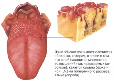 Бородавки на языке. Причины и лечение