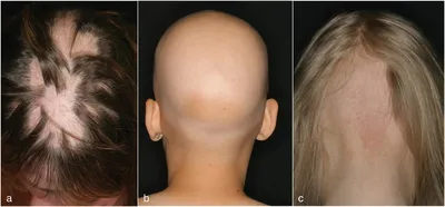 Скраб для кожи головы Natura Siberica Облепиховый для всех типов волос -  «Прям хайли рекоменд!!! Смотрите фото» | отзывы