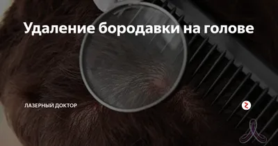 Удаление новообразований на коже головы в Москве
