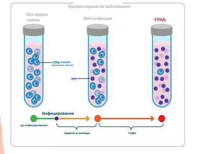 Удаление остроконечных кондилом в Киеве — Derma.ua