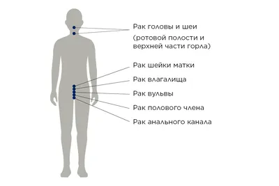 Папилломы: виды, проявления, удаленние и особенности лечения у мужчин и  женщин