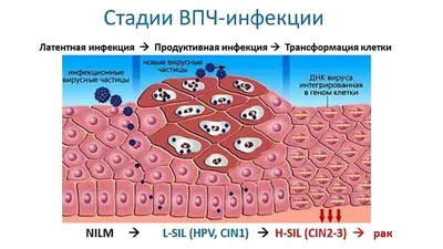 Вирус папилломы человека (ВПЧ) – симптомы, причины, диагностика и лечение  заболевания | «Будь Здоров»