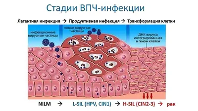ВПЧ — что это такое и как лечить инфекцию. | ushakovbogaevsky | Дзен
