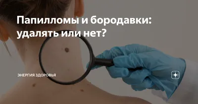 Красные родинки - Клиника «ЛИЦ» — современный медицинский центр в СПб