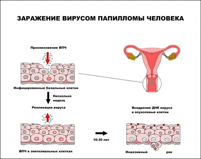 Не виноватый я! Он сам растёт!\"(c) Вирус папилломы человека | Пикабу