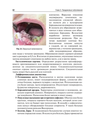 Рак полости рта и гортани