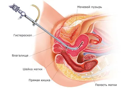 K-MED - 📍Папиллома– доброкачественное кожное образование, вызванное ВПЧ  (вирусом папилломы человека). Передается половым и бытовым путями при  контакте со слизистыми зараженного ВПЧ. 📍Кондилома – бородавкообразное  образование на слизистых и коже ...