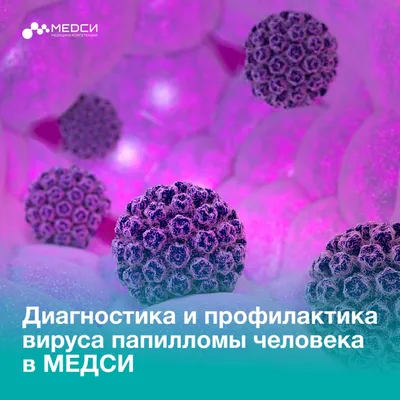 Что такое бородавка: виды, причины, симптомы, лечение | МЦ Лазерсвiт