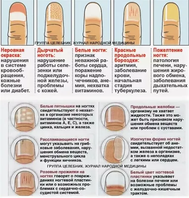 Объемные обертывания для ногтей Полуотвержденные полоски для ногтей  Блестящие черные рождественские ногти