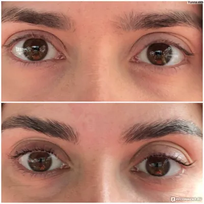 Ботокс для ресниц Lovely Lash Botox «B-Active»