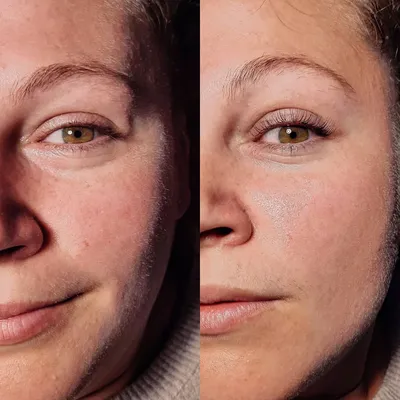 Как процедура «ботокс ресниц» меняет взгляд: 20 реальных фото до и после |  WDAY