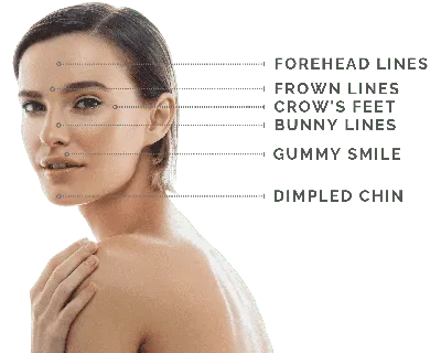 BOTOX Treatment Chesterfield, MO - West County Dermatology