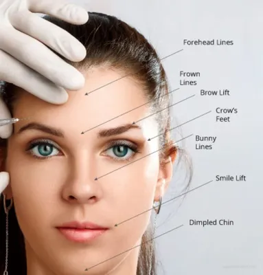 7 Bad Botox Reactions And How to Manage Them - pureskinlasercenter.com