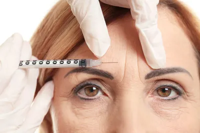 BOTOX Injections in Santa Rosa and Healdsburg