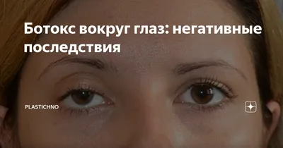 Мой глаз обвалился после инъекции ботокса\" | Woman.ru | Дзен