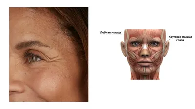 Ботокс до и после, фото губ после уколов Botox