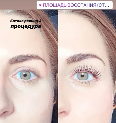 Процедура BOTOX LASHES (ботокс ресниц) - «Ботокс для очень коротких и очень  прямых ресниц. Правда ли, что ботокс подходит только длинным ресничкам?  Можно ли совсем обойтись без туши? Сколько продержится эффект? Осторожно,