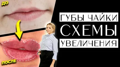 Увеличение губ в Базарном Карабулаке - Услуги косметологов - Красота: 21  косметолог