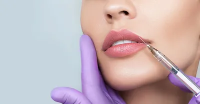 Контурная пластика губ - клиника лазерной косметологии в Москве