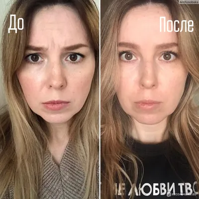 Ботокс и филлеры для мужчин: отзывы | Beauty Insider