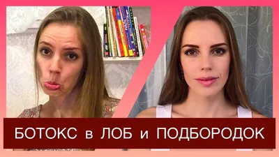 Ботокс в подбородок / Решение спазма врач-косметолог Шестакова