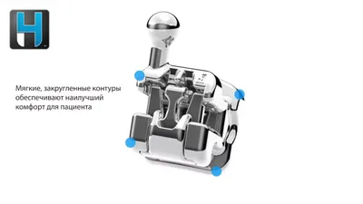 Брекеты H4: особенности, цена установки в Москве | НоваДент