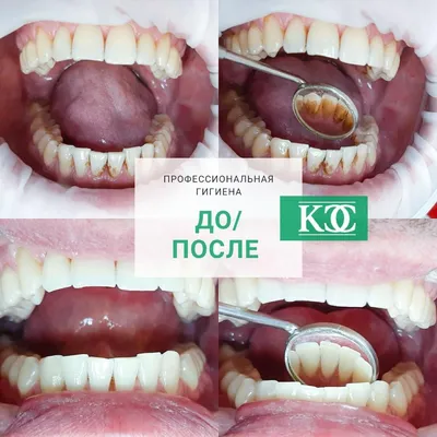 Результаты работы: установка брекетов, стоматология — Samara Med (Самара  Мед)