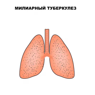 Абсцесс: лечение, последствия, причины, симптомы, виды, диагностика и  осложнения заболевания