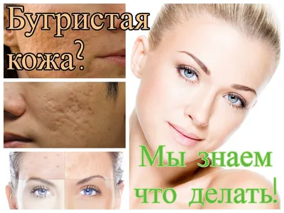 Что делать? бугристая кожа лица... - Beauty Code clinic | Facebook