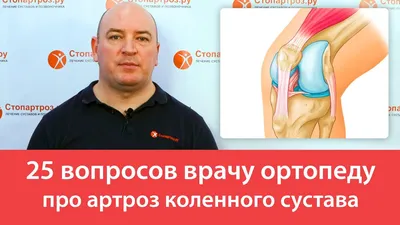 Артроз коленного сустава: причины, симптомы, виды, стадии, лечение без  операции в Москве