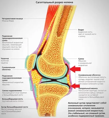 Бурсит: симптомы и лечение | ZOJ.KZ | Дзен