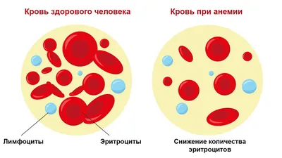 Рак кожи - симптомы и признаки | Центр лечения онкологии СМ-Клиники