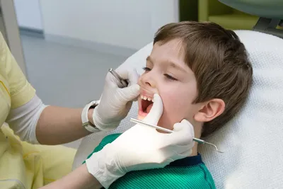 Почернели зубы - что делать? Причины, лечение и профилактика черных зубов