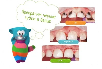 У ребенка почернели зубы, что делать? - Центр охраны материнства и детства  г.Магнитогорск