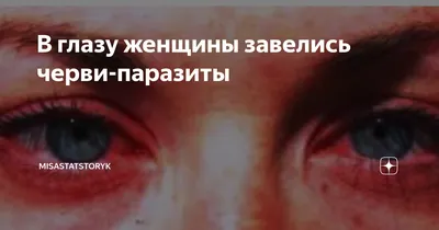 Как в глазах человека могут завестись черви? - Hi-News.ru