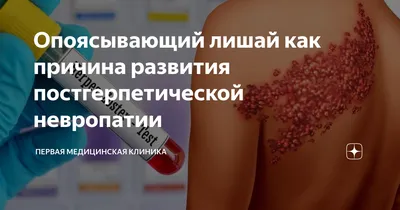 Дерматологические проявления вирусных инфекций. Часть 2