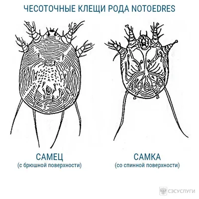 Чесотка